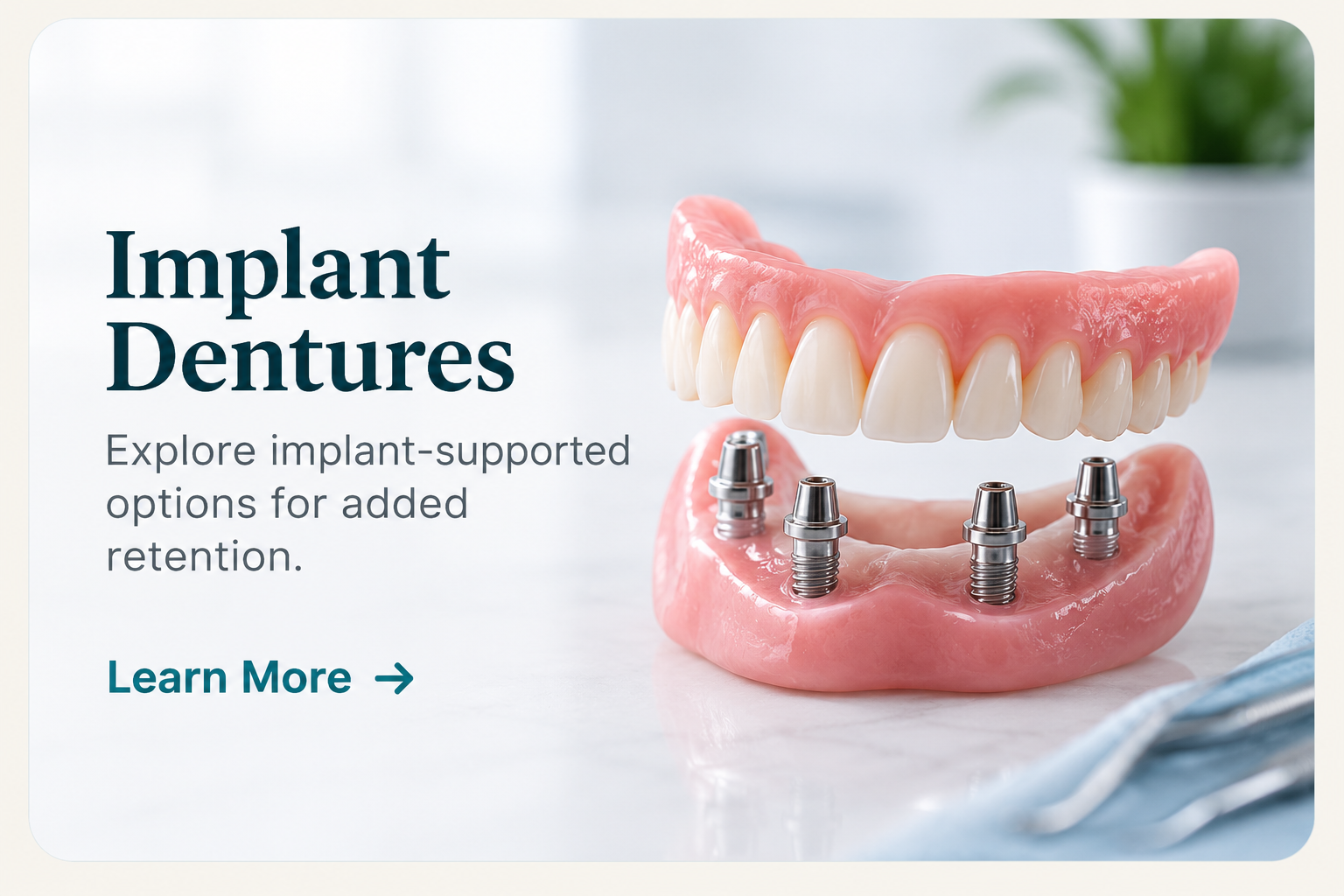 Implant Dentures at Future Smiles Denture Clinic Calgary