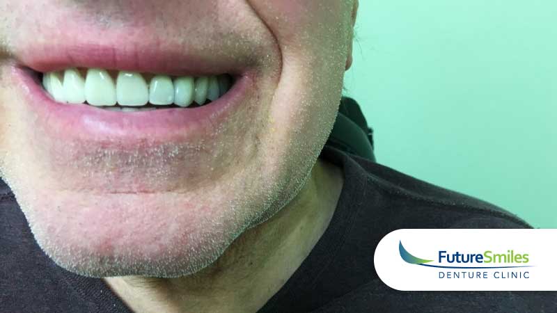 Future Smiles patient case #3