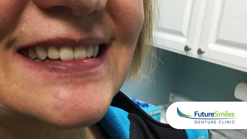 Future Smiles patient case #5