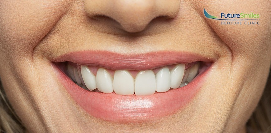 Denture-implants-life-changing, dentures, missing teeth
