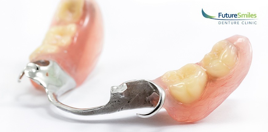 Getting-partial-dentures, missing teeth