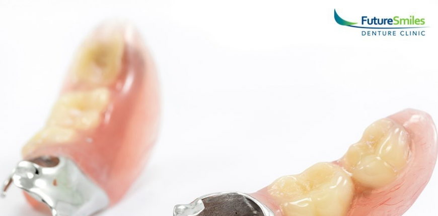 partial dentures calgary