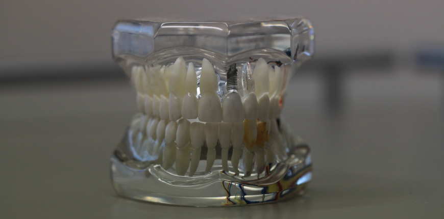 The Future of Your Teeth