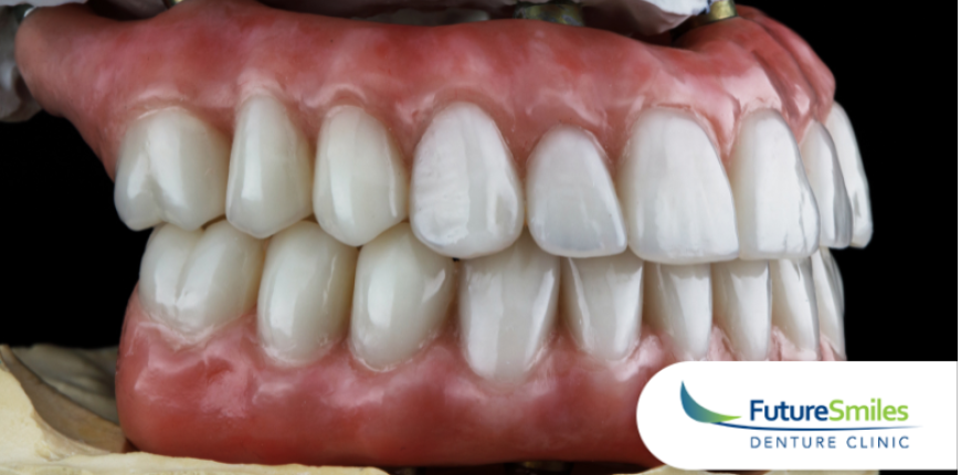 Denture Myths vs. Facts: Calgary Denturist Busts Common Misconceptions 