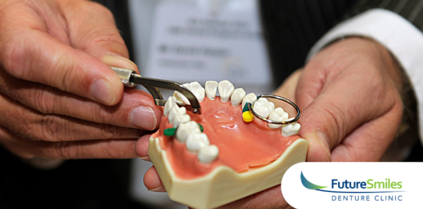 Your Guide to Dentures in Calgary: Full, Partial, Implants, and More 