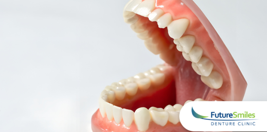 Emergency Denture Repairs in Calgary: What to Do When Something Breaks 