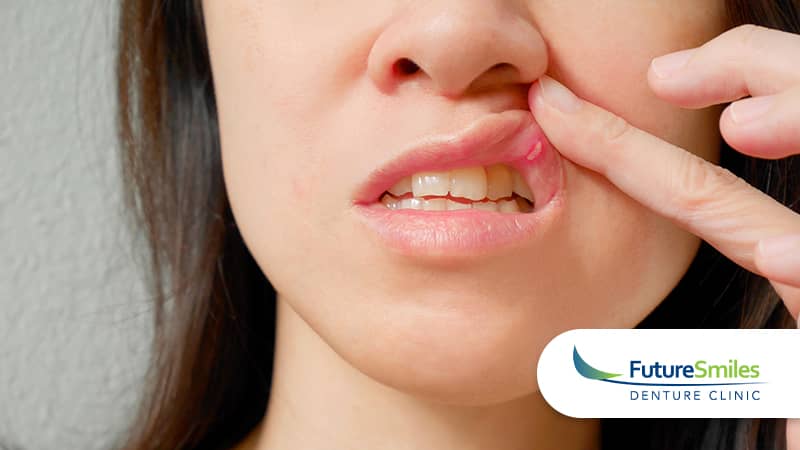 What Is Denture Stomatitis?