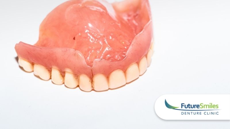 Broken Dentures? Emergency Denture Repair Services in Calgary