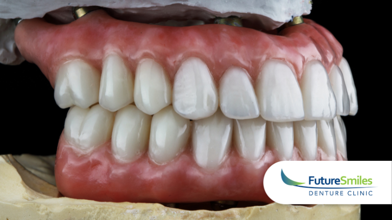 Denture Myths vs. Facts: Calgary Denturist Busts Common Misconceptions 