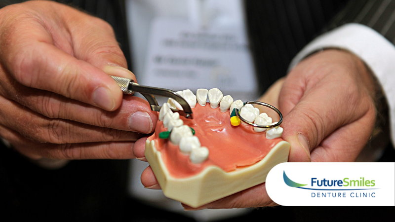 Your Guide to Dentures in Calgary: Full, Partial, Implants, and More 