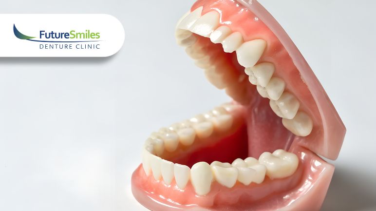 What Is a Denture Reline and When Do You Need One? – Calgary Denture Reline